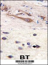 VILIP1 Antibody