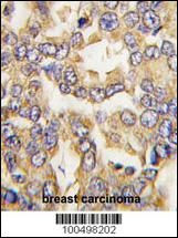VILIP1 Antibody