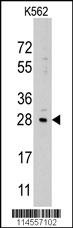 LIN28B Antibody