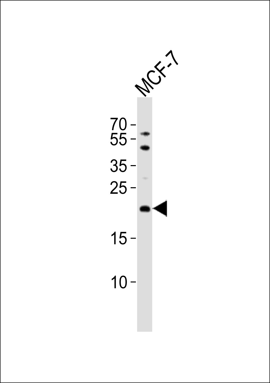 TIMM23 Antibody