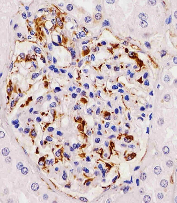 RHBDF2 Antibody