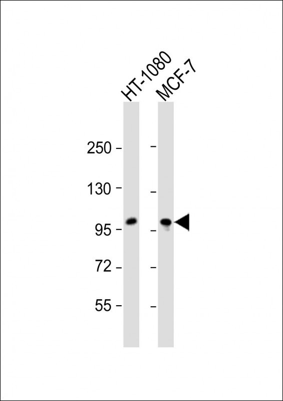 RHBDF2 Antibody