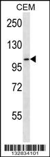 RHBDF2 Antibody