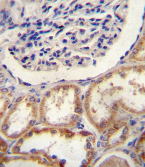 HtrA1 Antibody