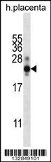 CGB/HCG-Beta Antibody
