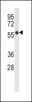 FADS2 Antibody