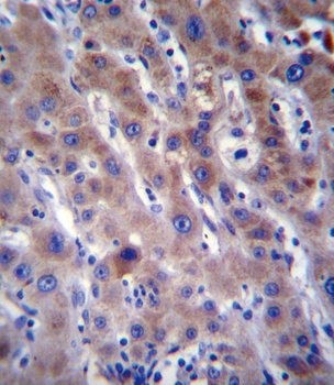 FADS2 Antibody