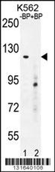 DEPD5 Antibody