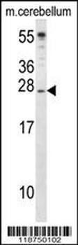 IGF2 Antibody