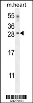 CLDN6 Antibody