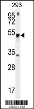 METTL4 Antibody