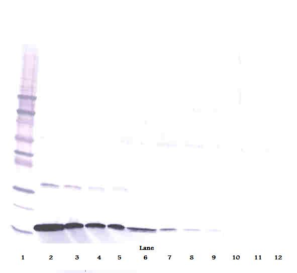 IFNG Antibody