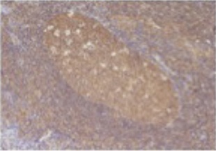 CCL5 Antibody