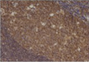 CCL5 Antibody