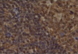 CCL5 Antibody