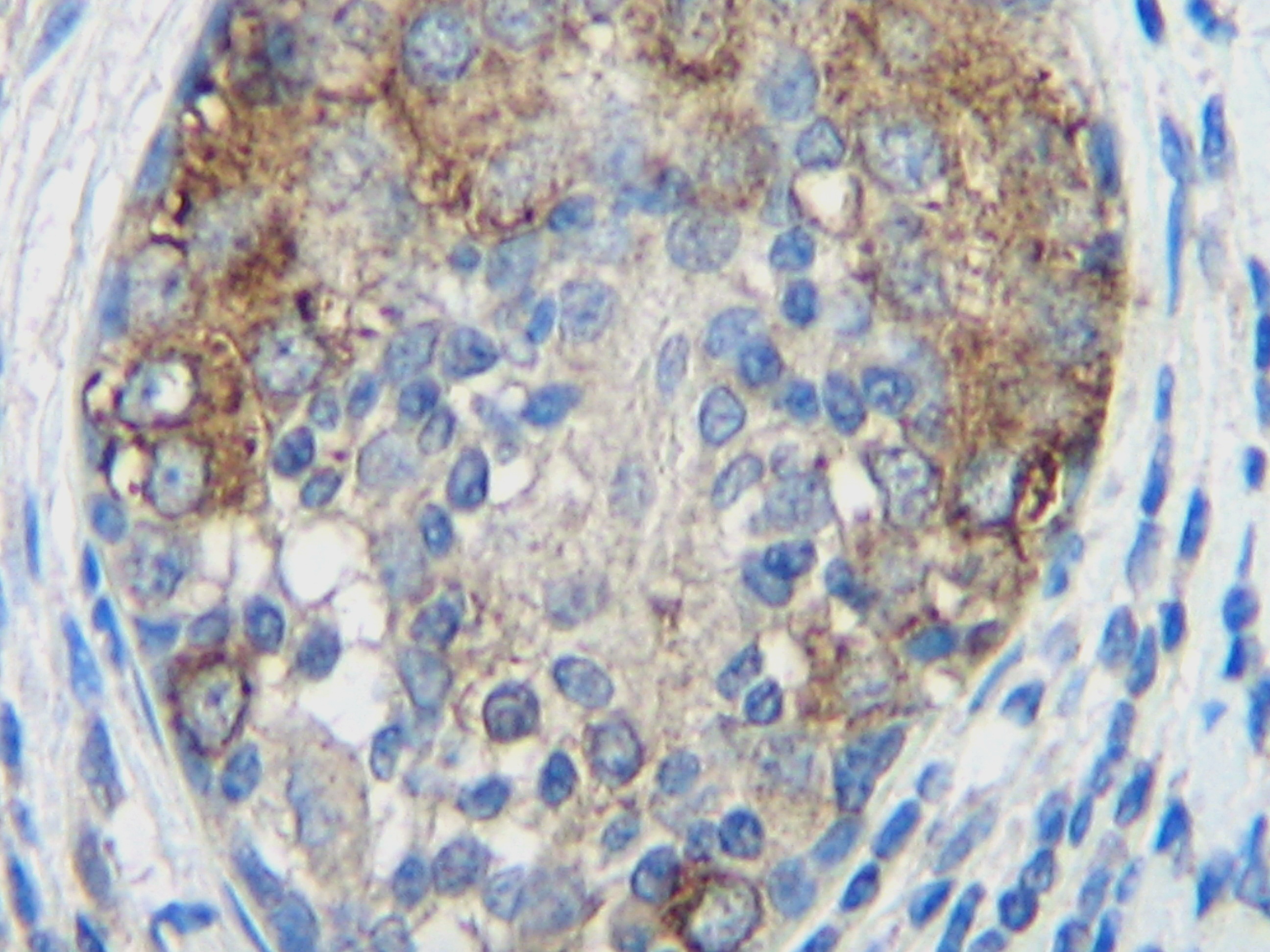 MCP-1 Antibody [2.2-4H5-01A11]