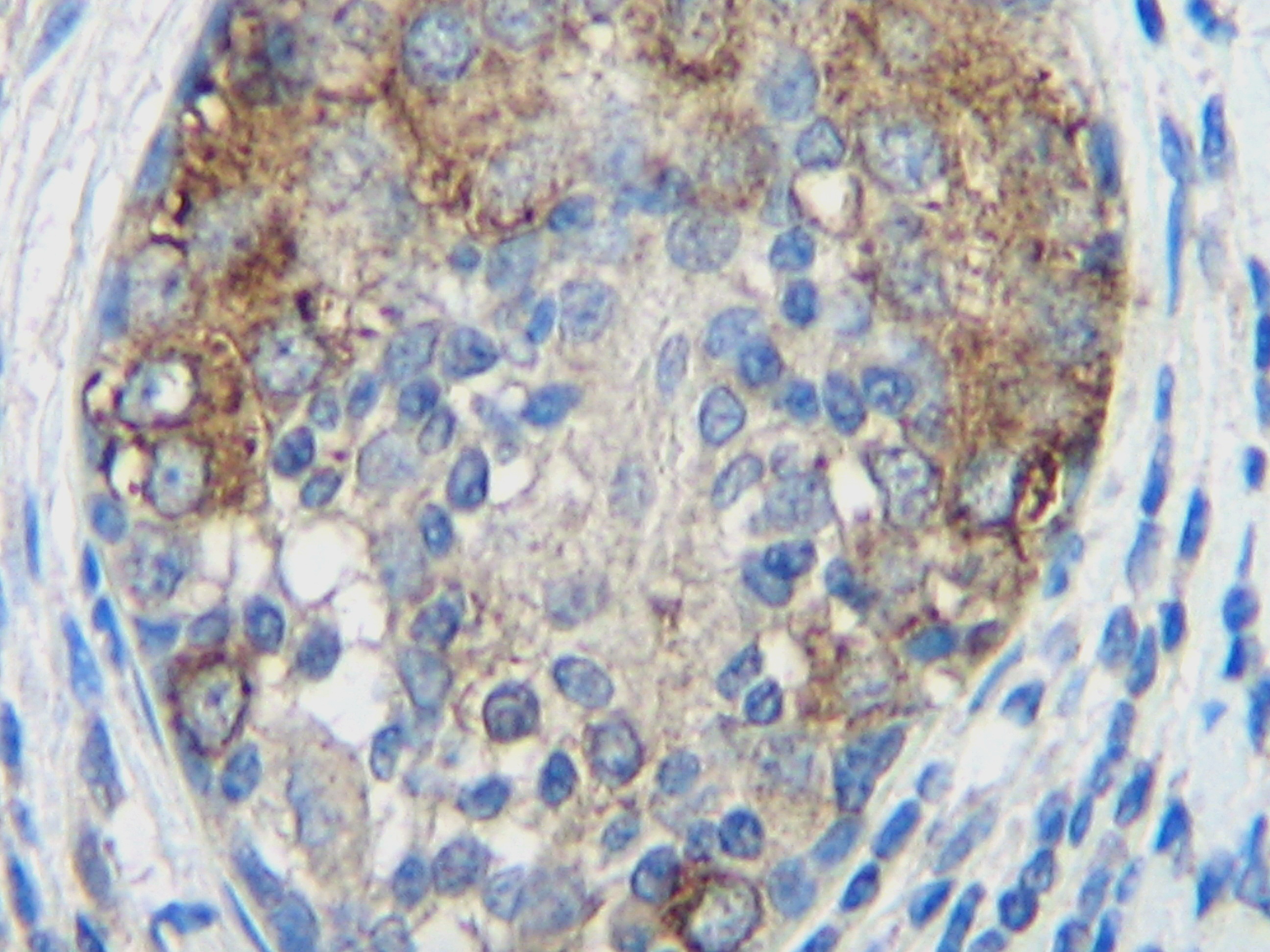 CCL2 Antibody