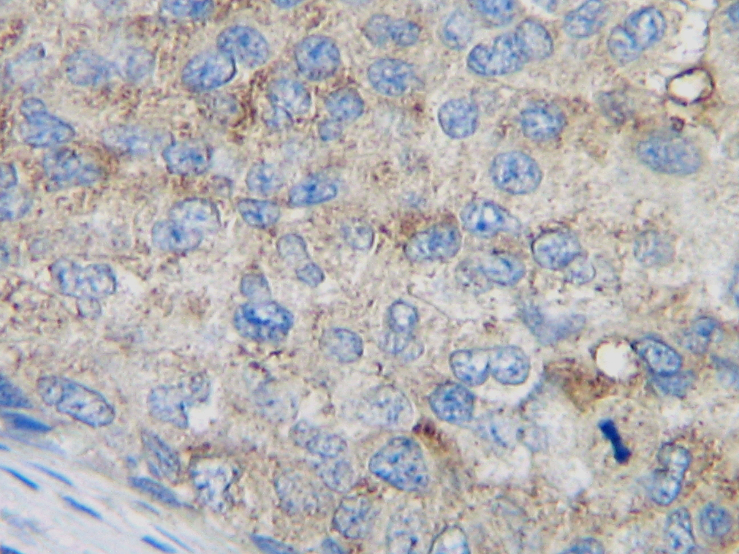 MCP-1 Antibody [2.2-4H5-01A11]