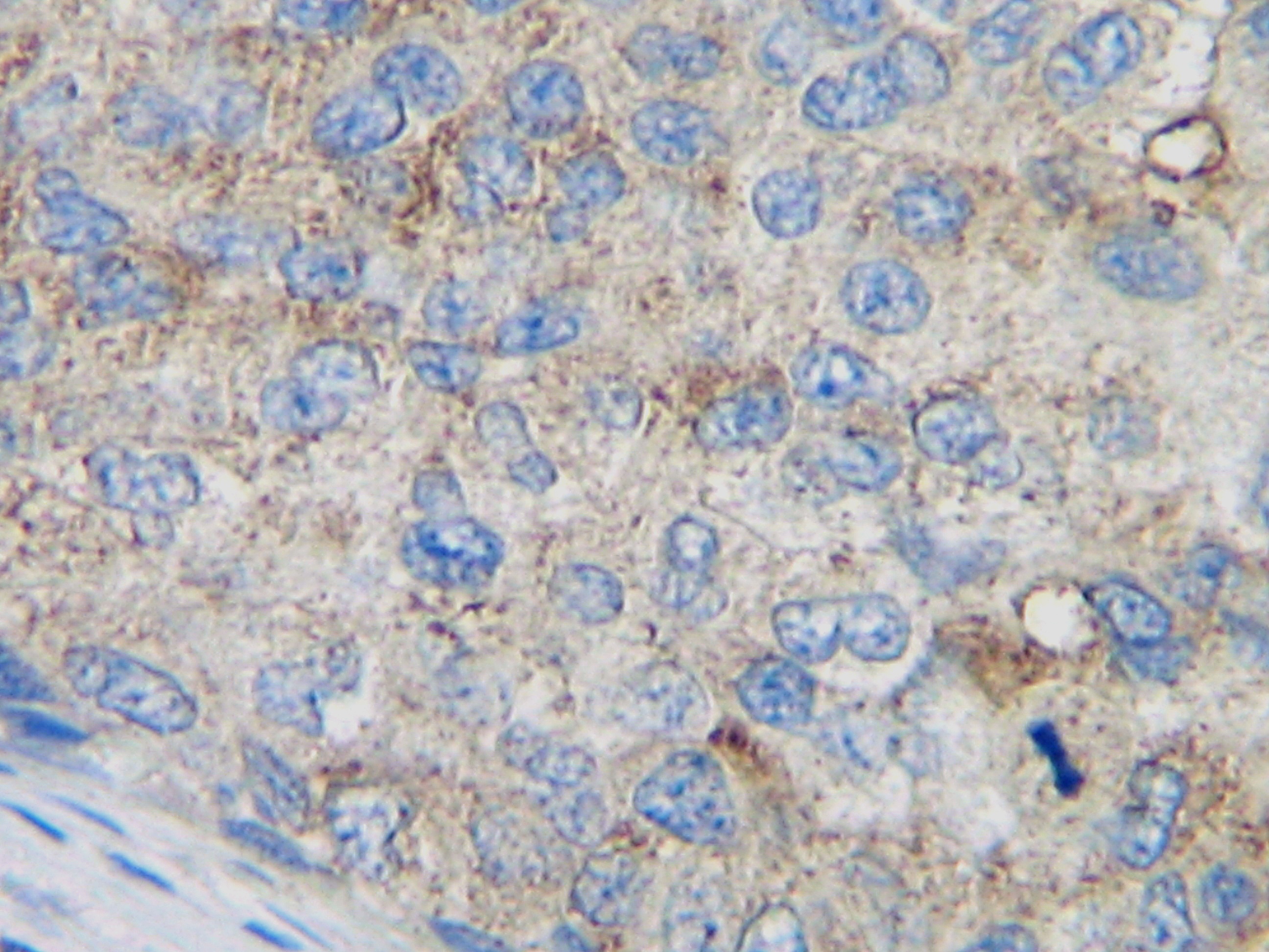 CCL2 Antibody