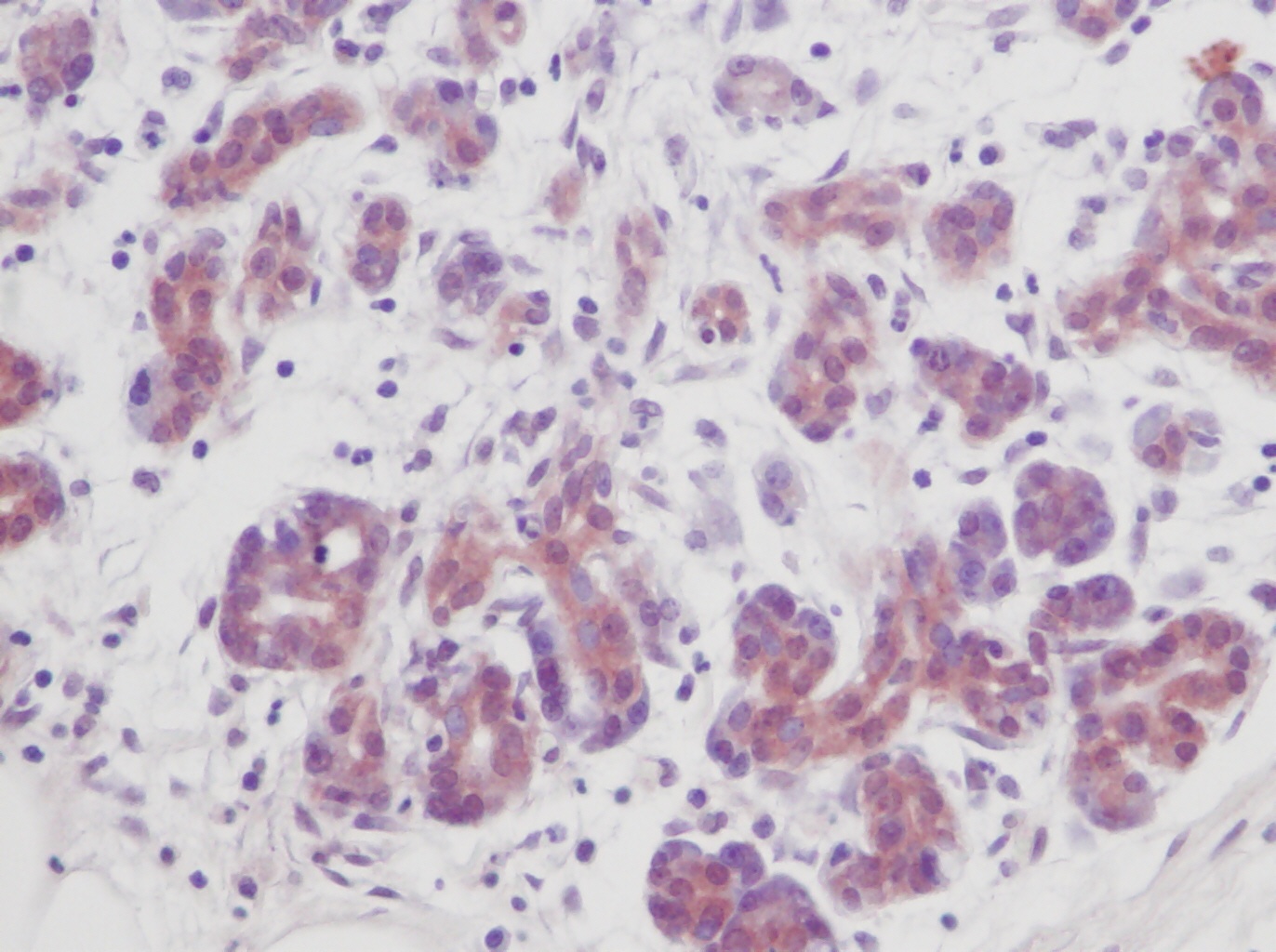 TNFSF10 Antibody
