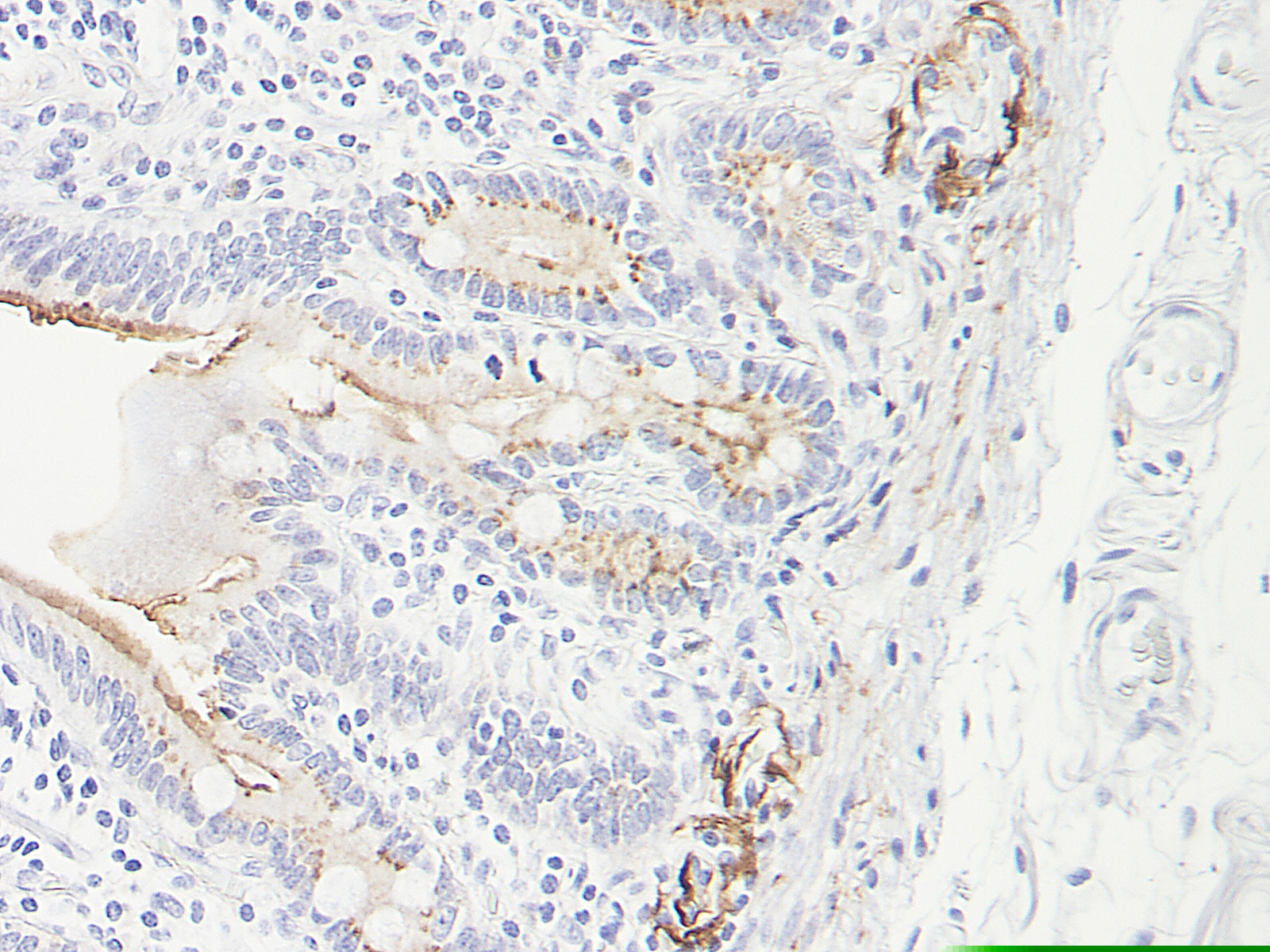 CCL25 Antibody