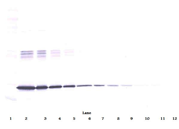 IL-6 Antibody [1.2-2B11-2G10]