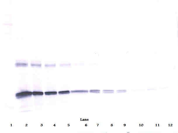 IL6 Antibody