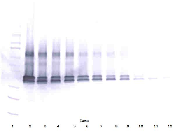 VEGF Antibody