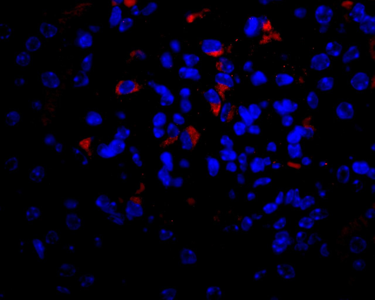 VEGF Antibody