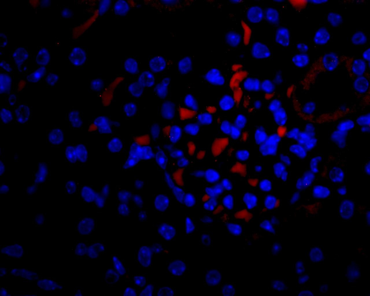VEGF Antibody
