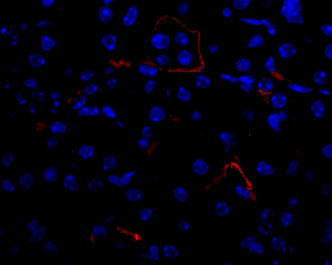 VEGF Antibody