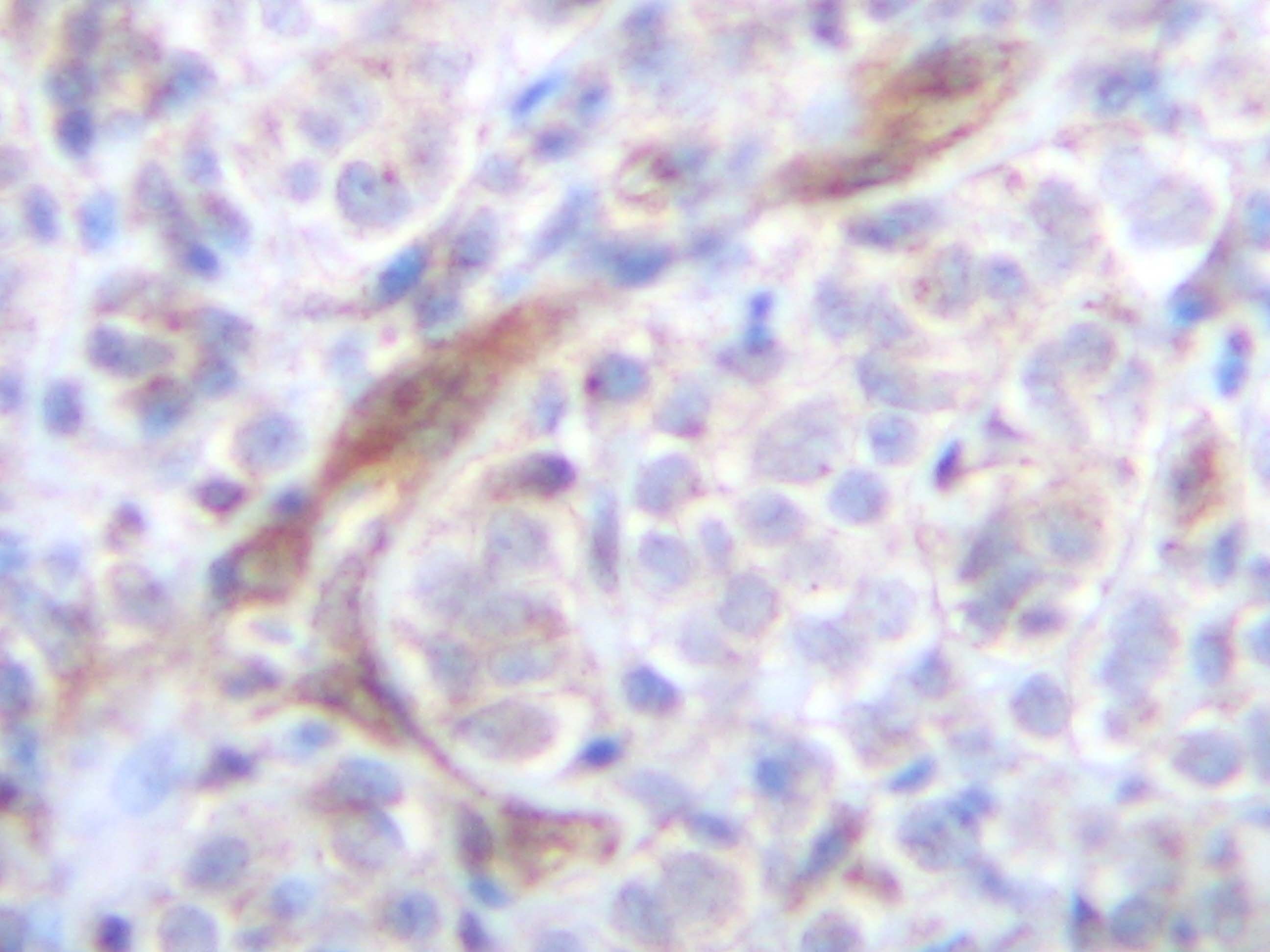TNFSF10 Antibody