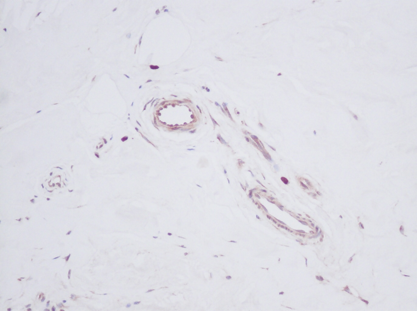 TGFA Antibody