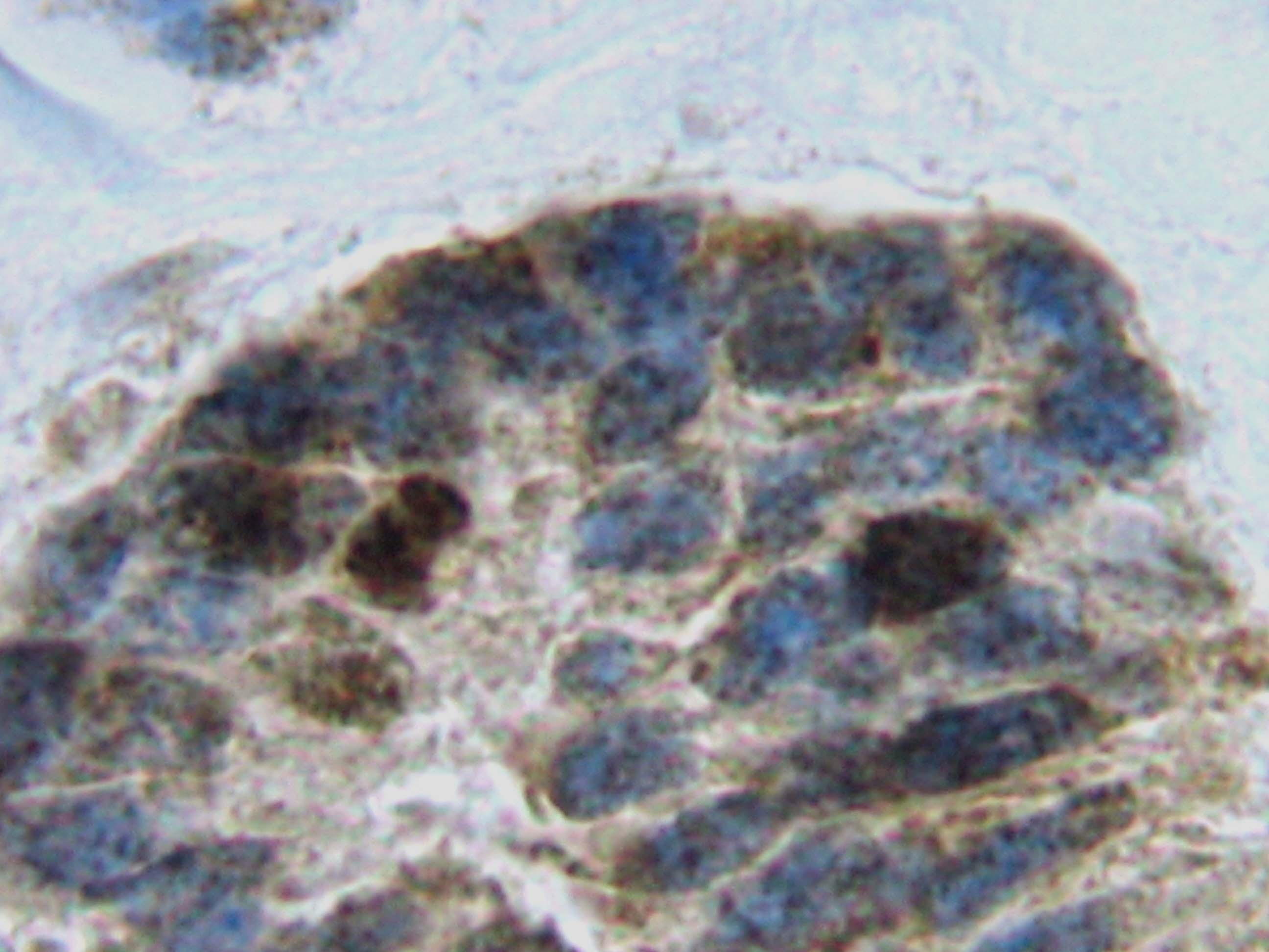 TNFRSF11A Antibody