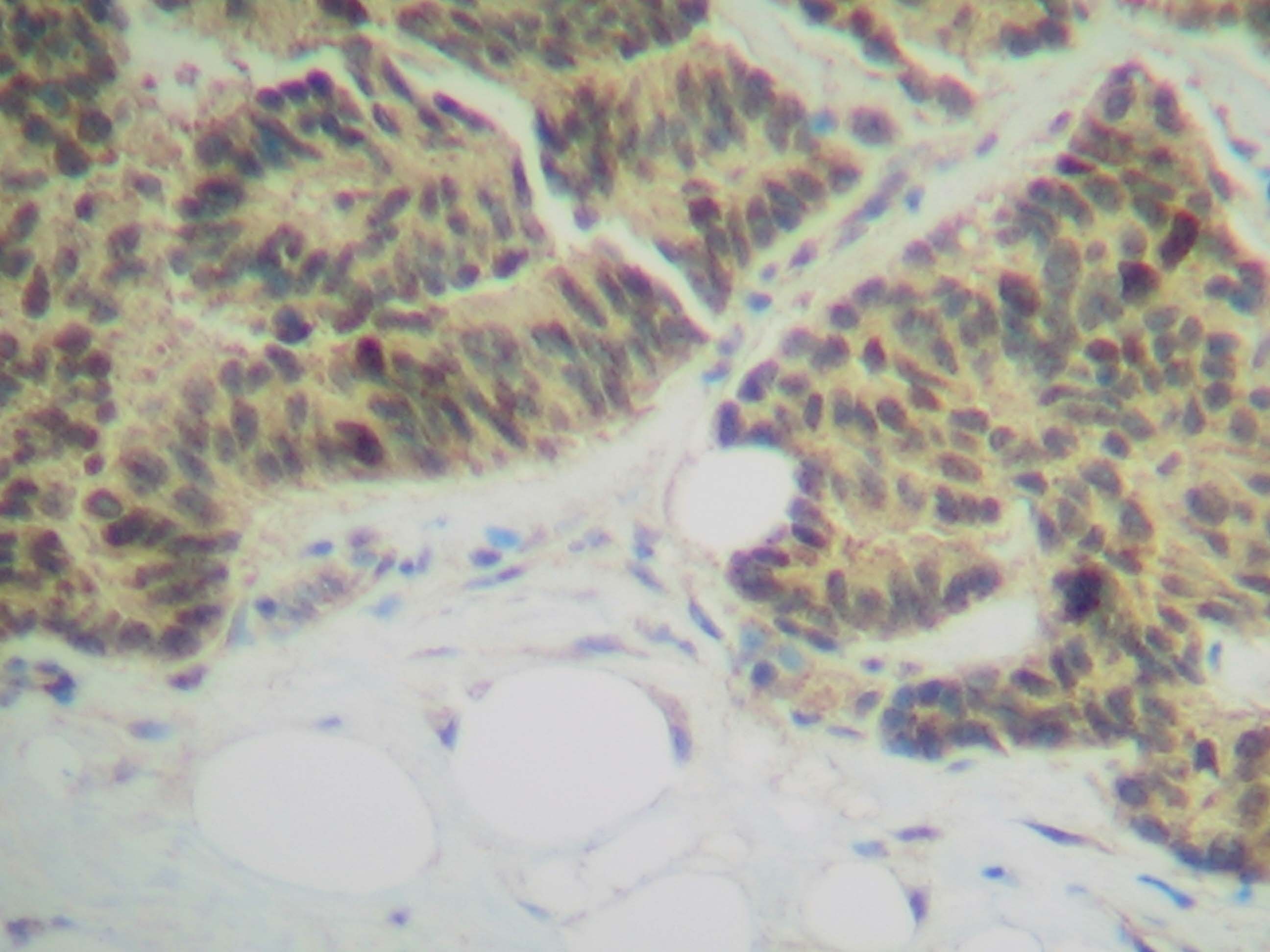 TNFRSF11A Antibody
