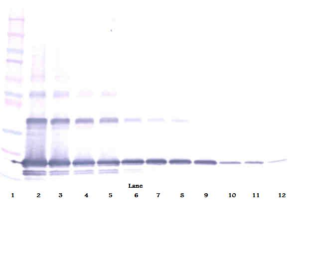 sRANK Ligand Antibody (biotin)
