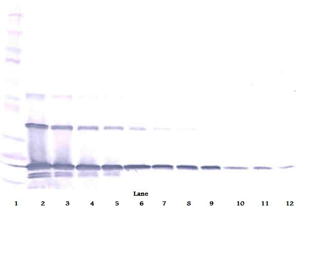 sRANK Ligand Antibody