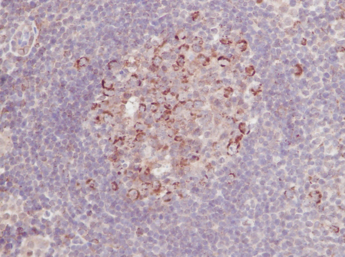 sRANK Ligand Antibody
