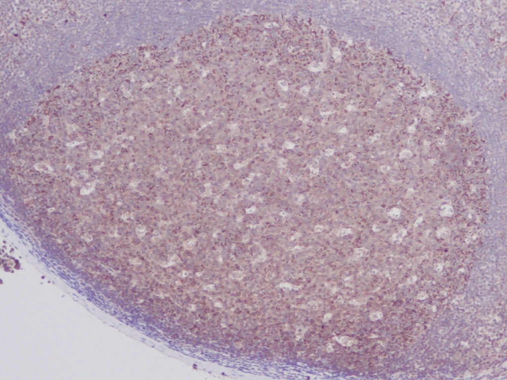 sRANK Ligand Antibody