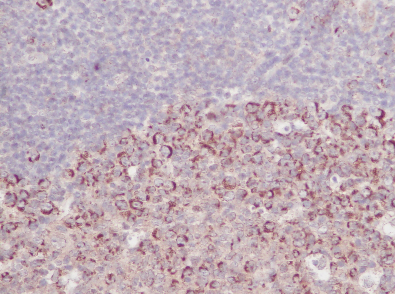 sRANK Ligand Antibody