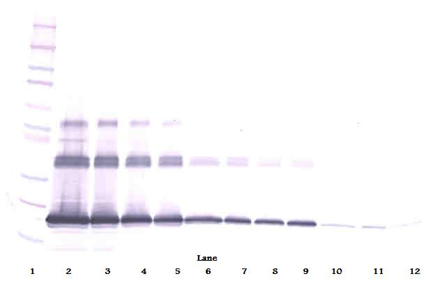 sRank Ligand Antibody