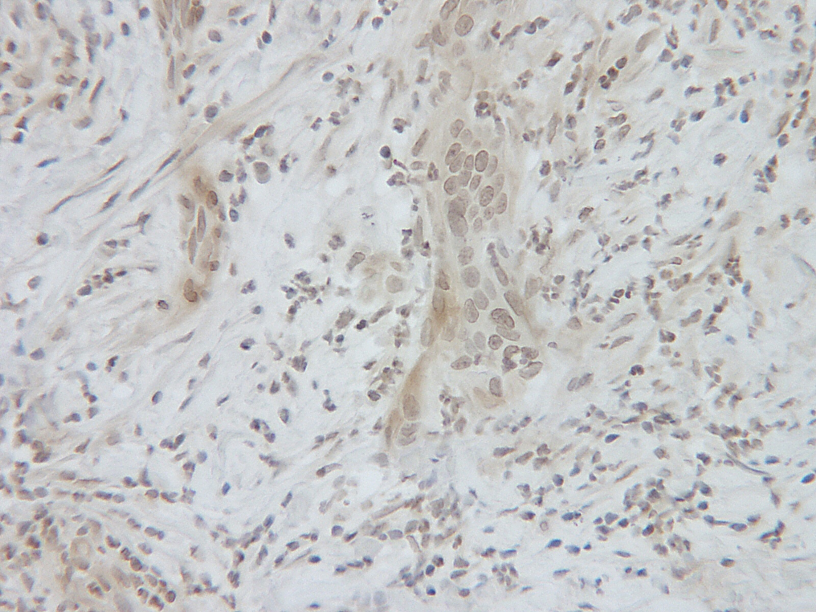 SDF-1B Antibody