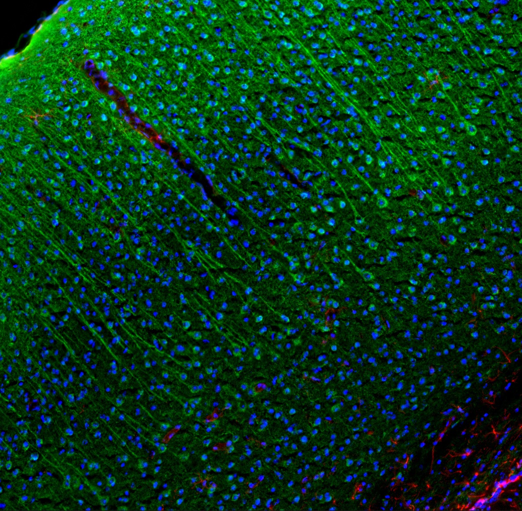 Ccl5 Antibody