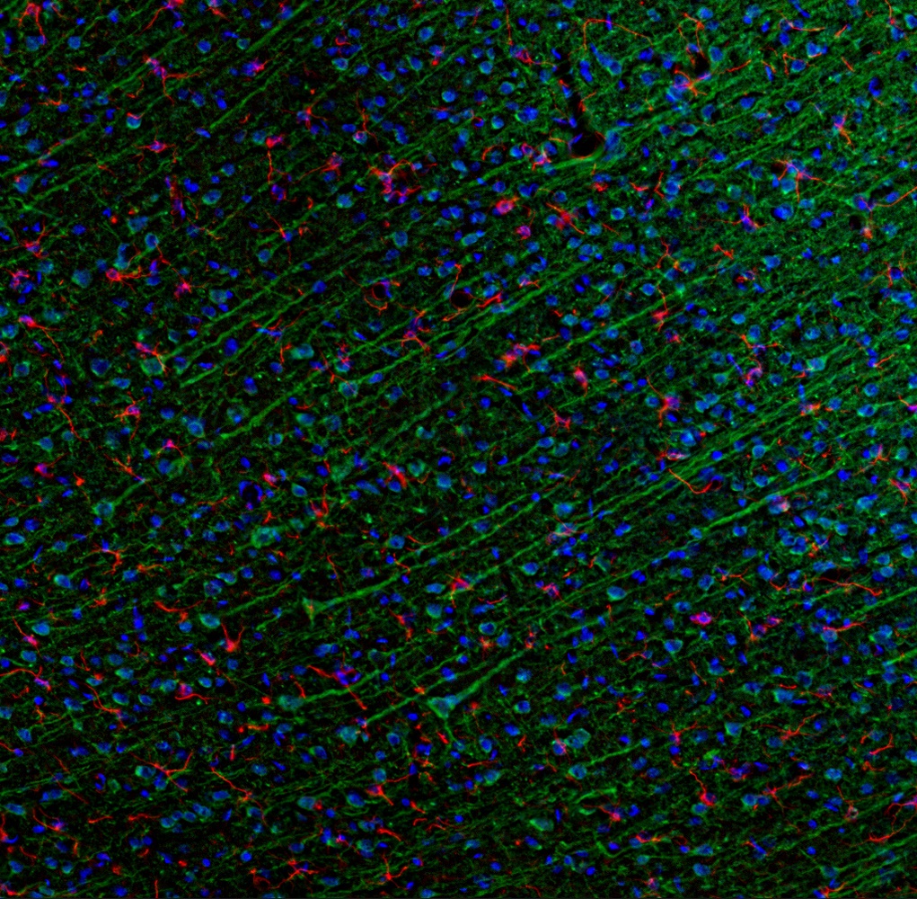 Ccl5 Antibody