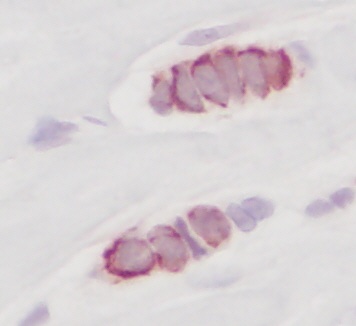 CCL5 Antibody