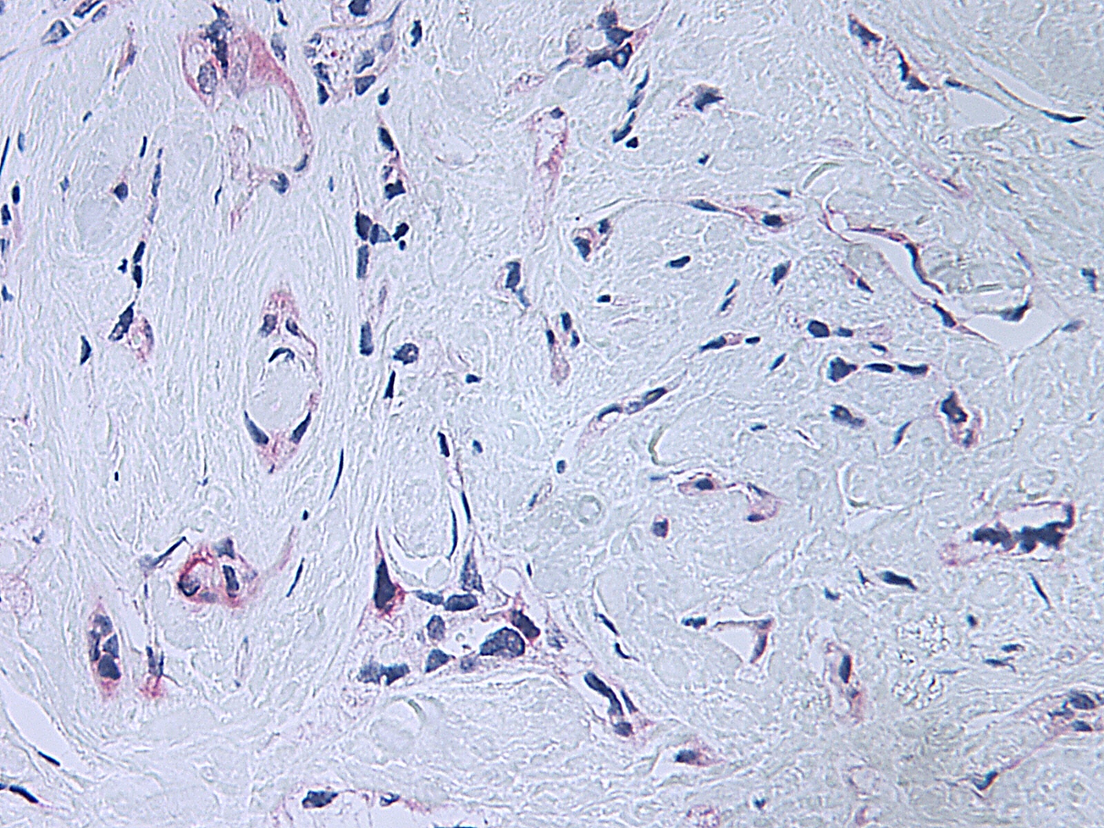 PF-4 Antibody