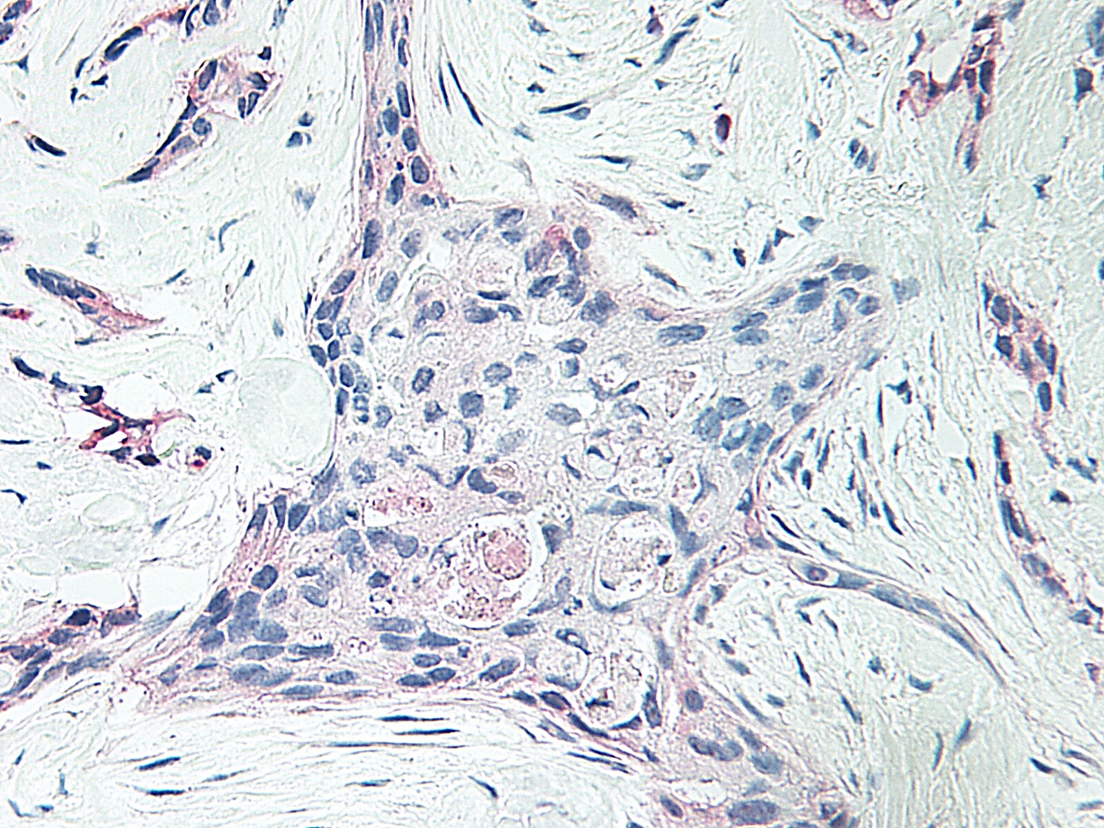PF-4 Antibody