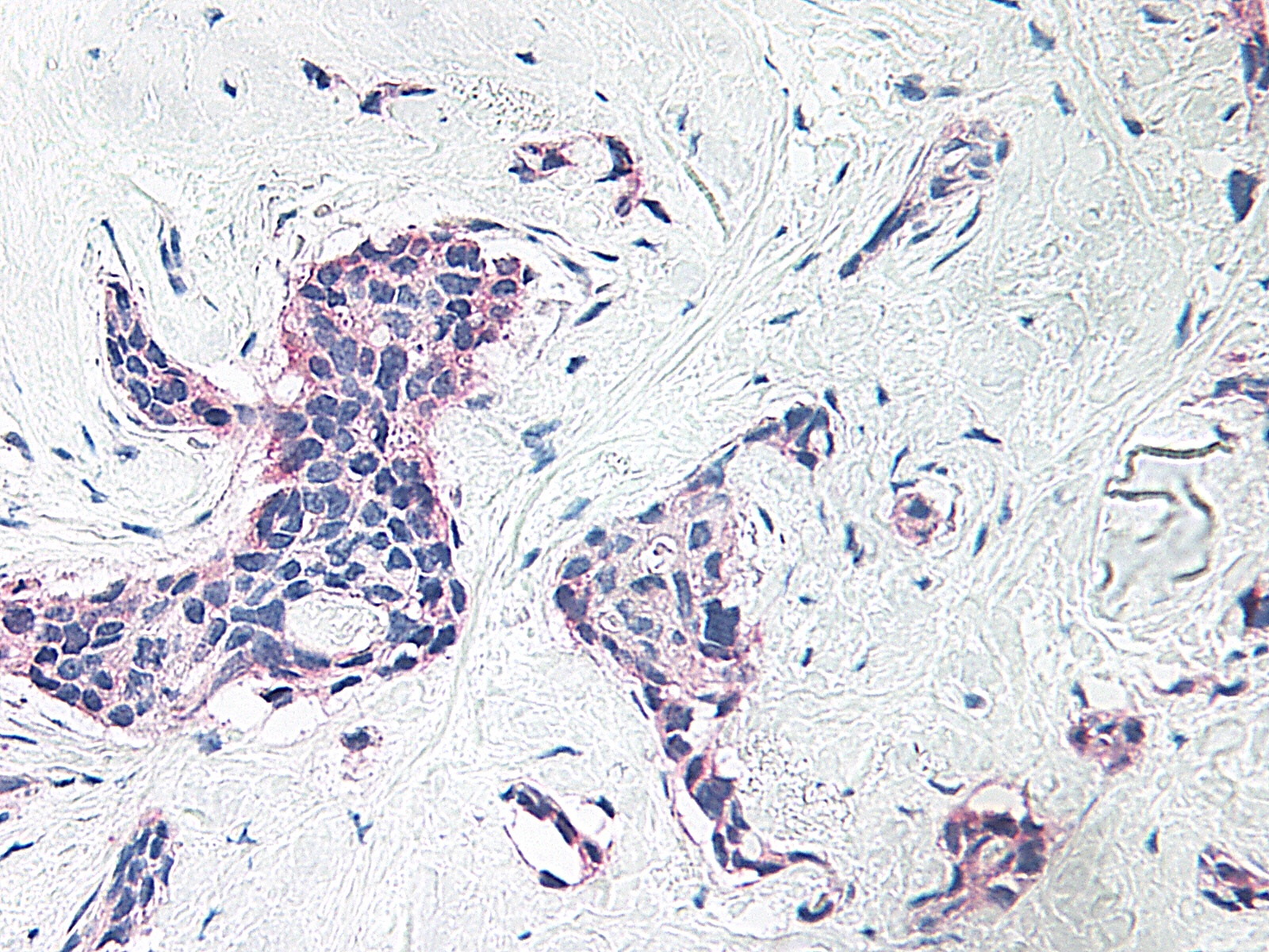 PF-4 Antibody