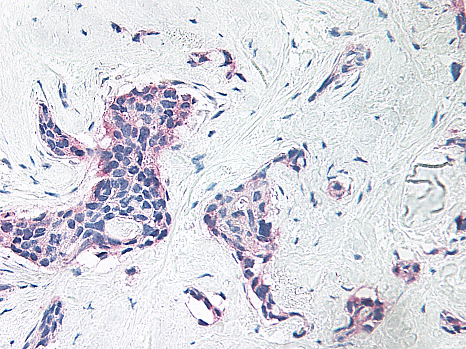 PF4 Antibody