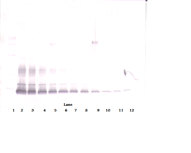 PDGF-BB Antibody